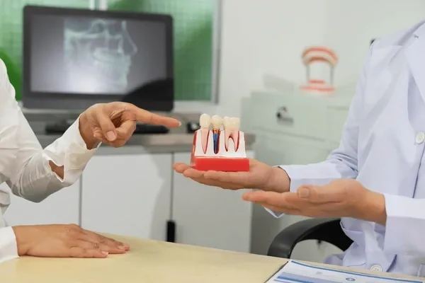 ایمپلنت دندان چقدر طول میکشد؟ بررسی مراحل و مدت زمان درمان