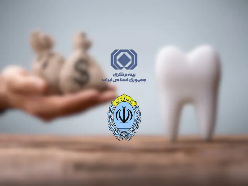 کدام بیمه تکمیلی هزینه ایمپلنت را می دهد