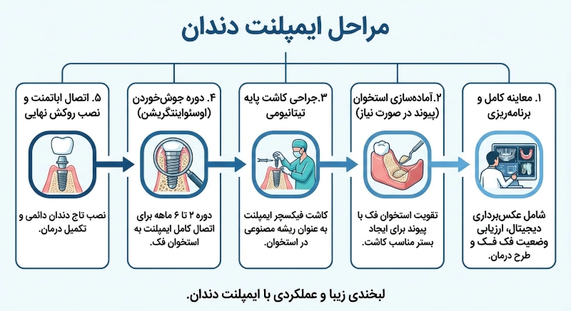 اینفوگرافی مراحل ایمپلنت دندان