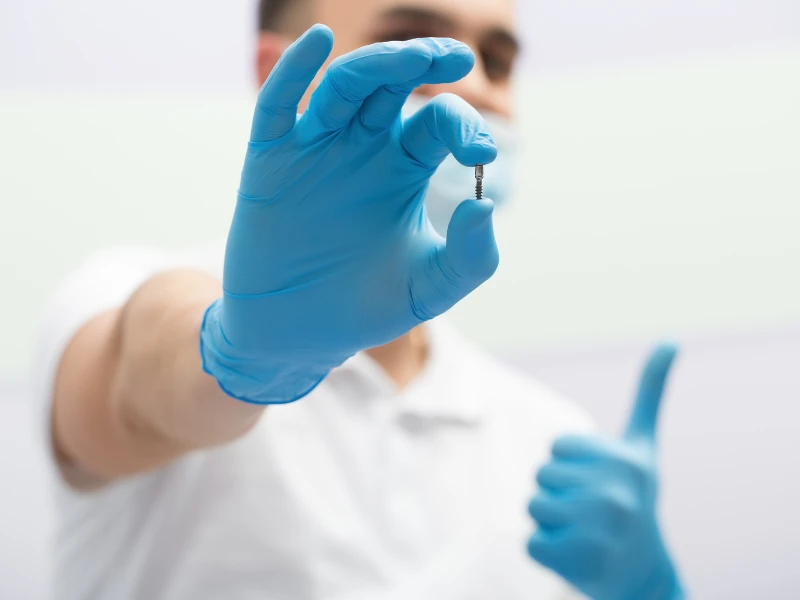 مراحل ایمپلنت دندان؛ از جراحی تا گذاشتن تاج در چند ...