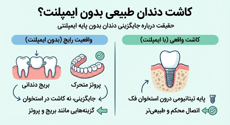 كاشت دندان طبیعی بدون ایمپلنت | آیا واقعاً ممکن است؟